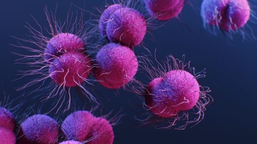 Cáncer Colorrectal